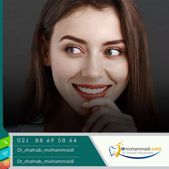 شرکت های وارد کننده ایمپلنت دندان در ایران